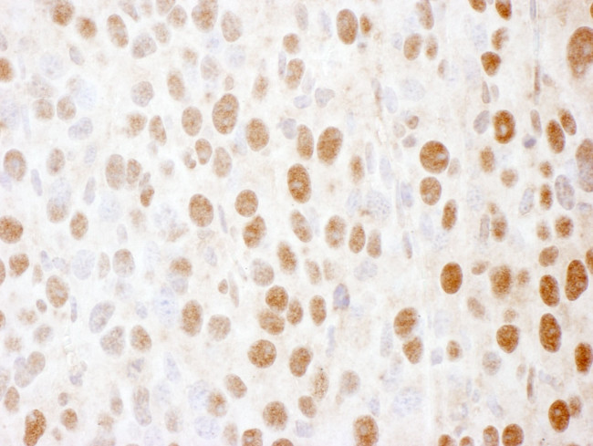 SS-B Antibody in Immunohistochemistry (IHC)