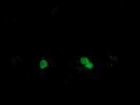 SSX1 Antibody in Immunocytochemistry (ICC/IF)