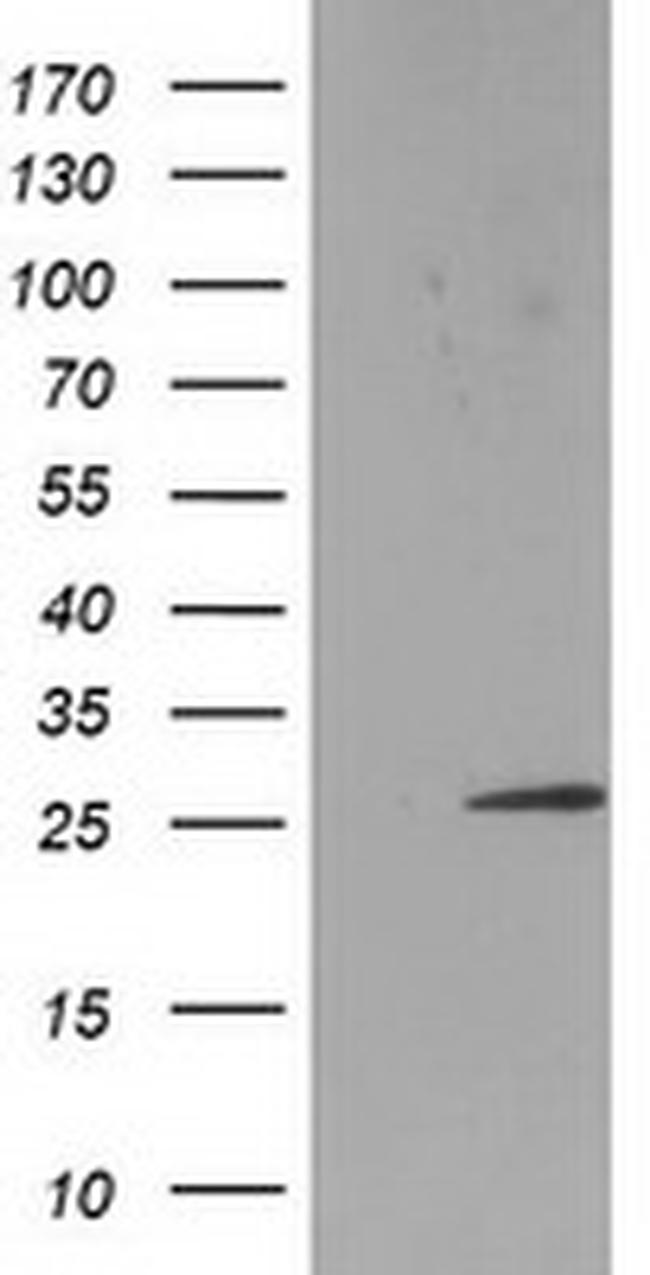 SSX1 Antibody in Western Blot (WB)