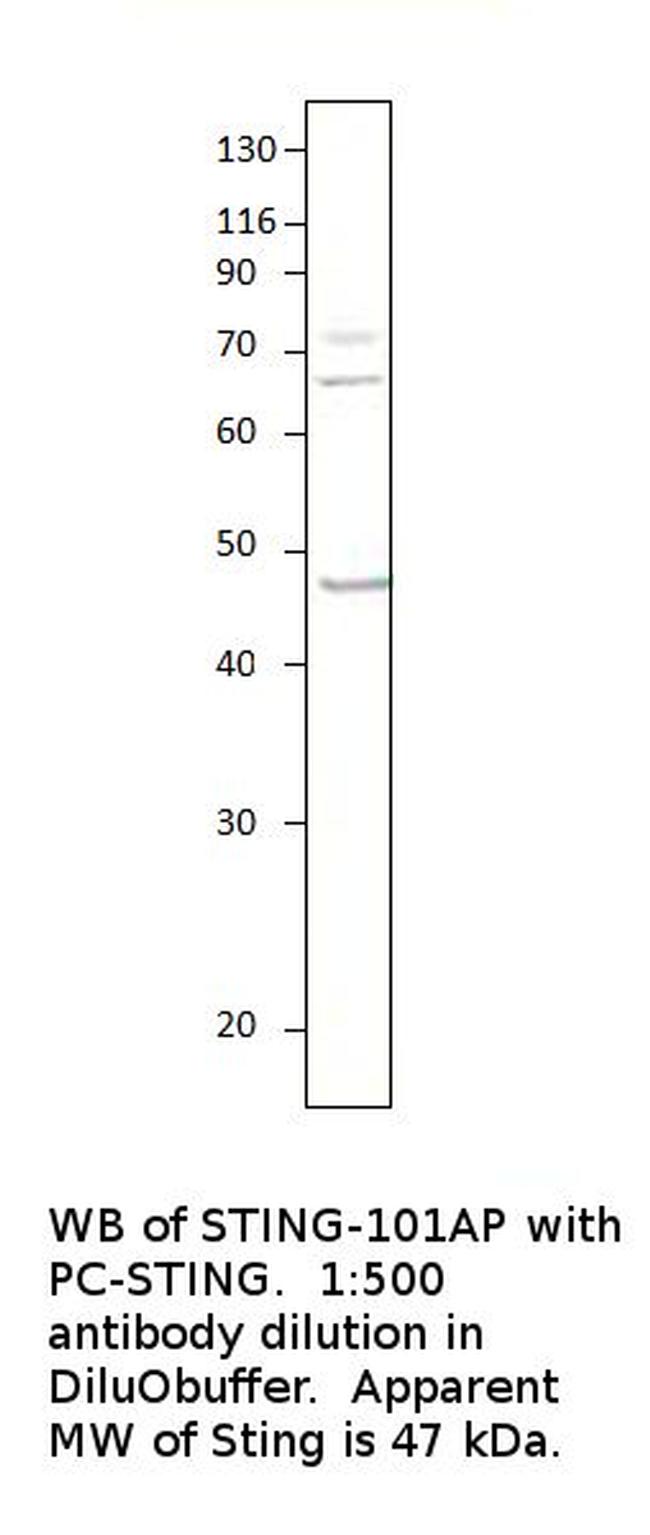 STING/TMEM173 Antibody in Western Blot (WB)