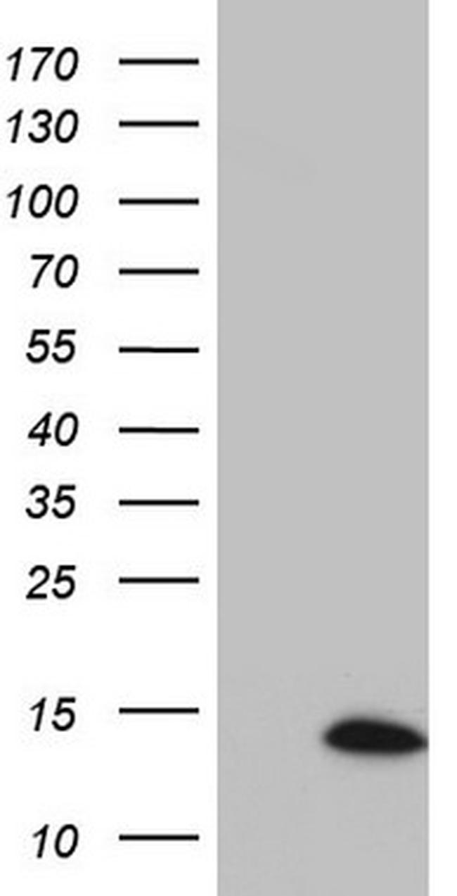 SUPT4H1 Antibody in Western Blot (WB)