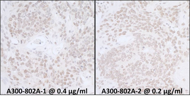 SUPT6H Antibody in Immunohistochemistry (IHC)