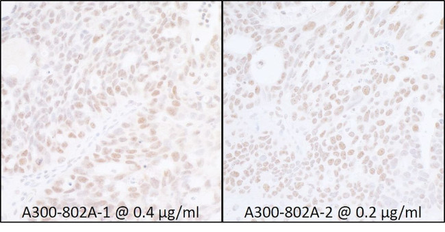 SUPT6H Antibody in Immunohistochemistry (IHC)