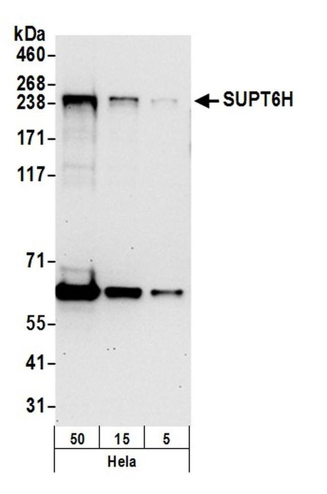 SUPT6H Antibody in Western Blot (WB)
