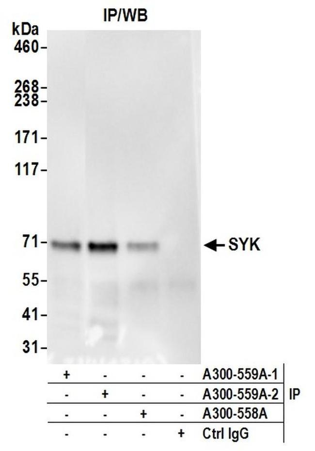 SYK Antibody in Western Blot (WB)