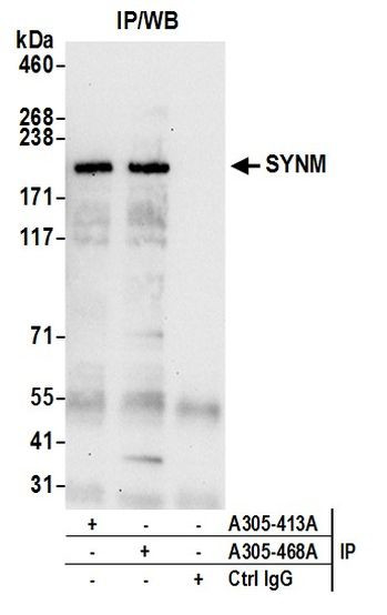 SYNM Antibody in Immunoprecipitation (IP)
