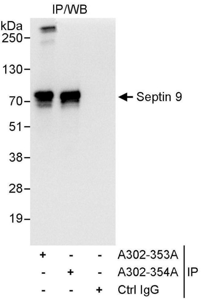 Septin 9 Antibody in Immunoprecipitation (IP)