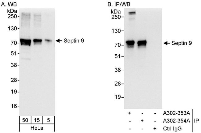Septin 9 Antibody in Western Blot (WB)
