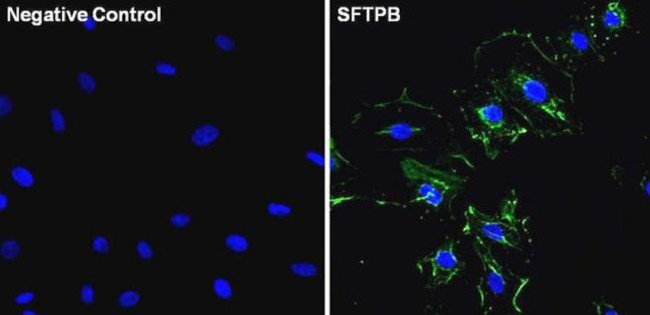 SFTPB Antibody in Immunocytochemistry (ICC/IF)