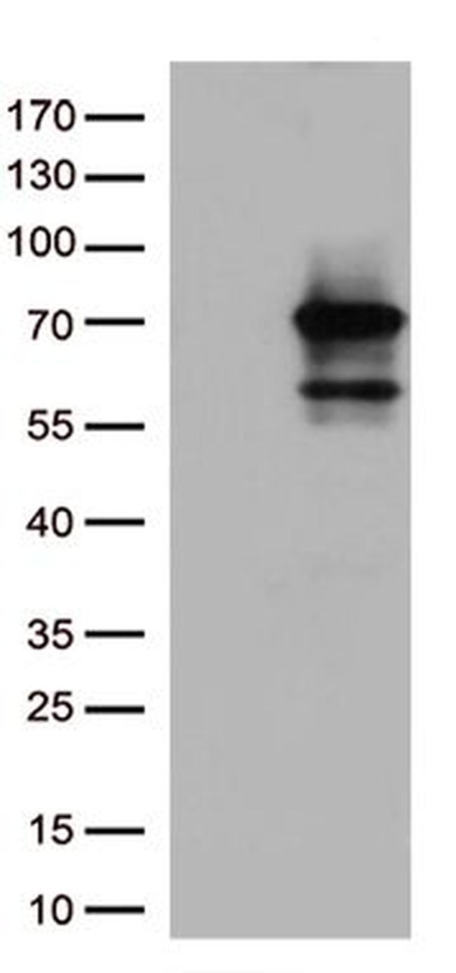 SEPT9 Antibody in Western Blot (WB)