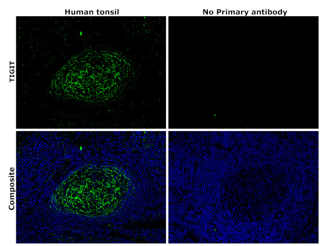 TIGIT Antibody in Immunohistochemistry (Paraffin) (IHC (P))