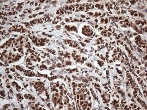 EWSR1 Antibody in Immunohistochemistry (Paraffin) (IHC (P))