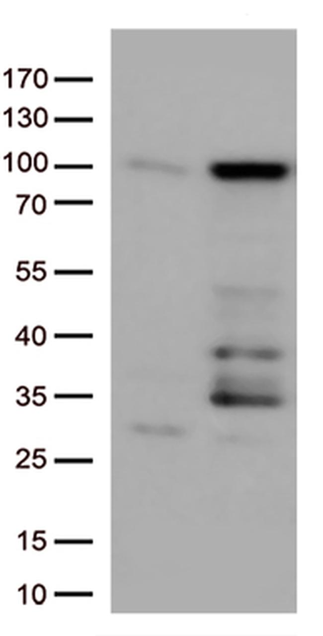 EWSR1 Antibody in Western Blot (WB)