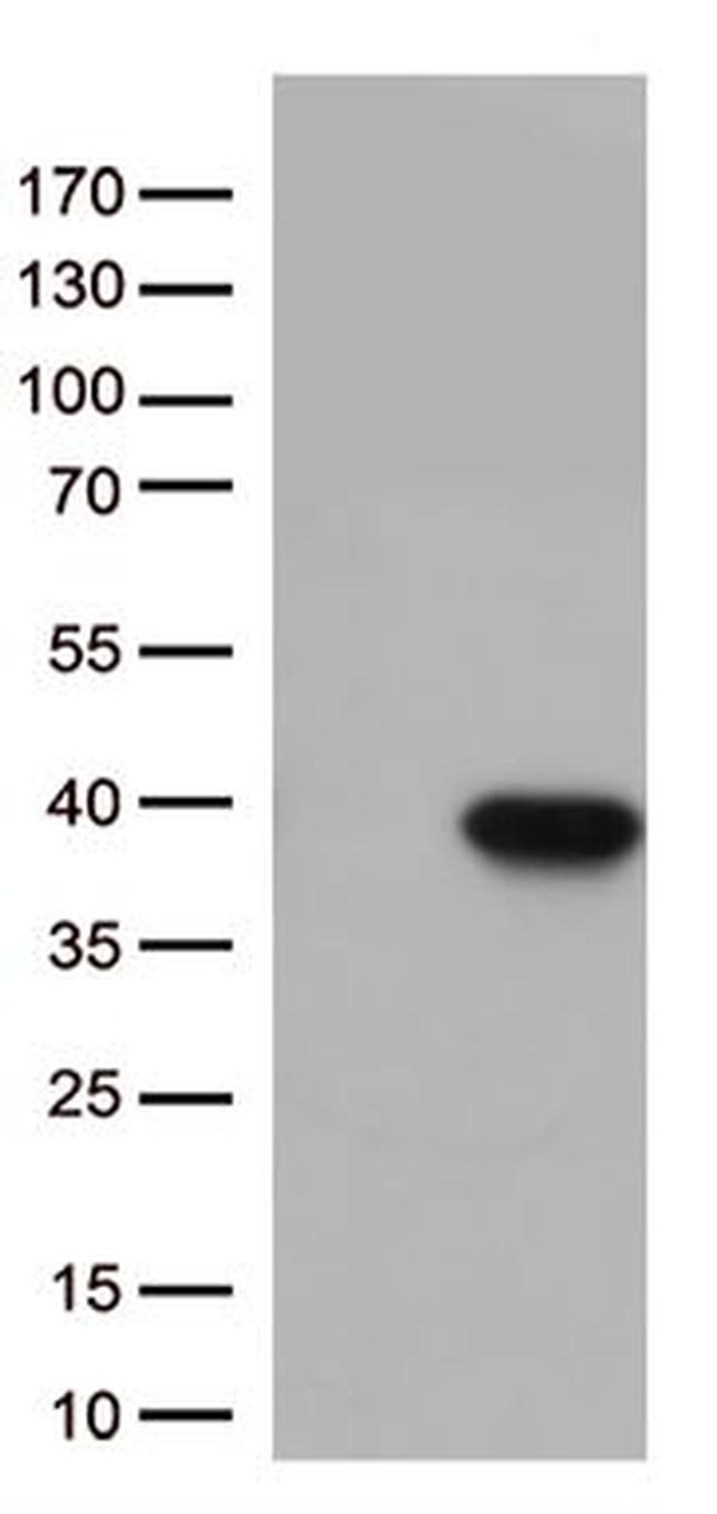 CASP3 Antibody in Western Blot (WB)