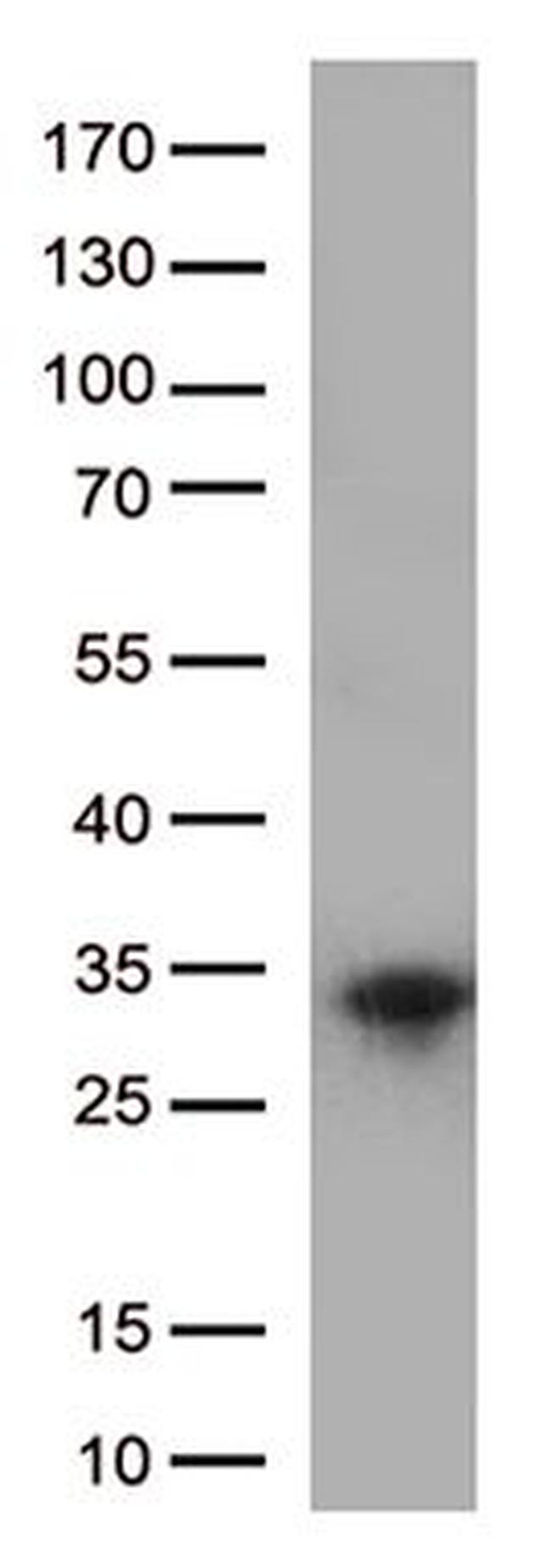 XPC Antibody in Western Blot (WB)