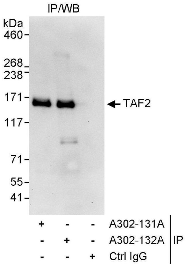 TAF2 Antibody in Immunoprecipitation (IP)