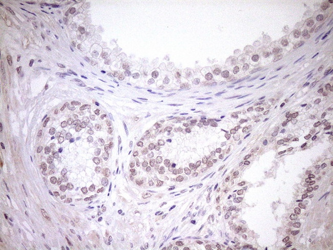 TCP10 Antibody in Immunohistochemistry (Paraffin) (IHC (P))