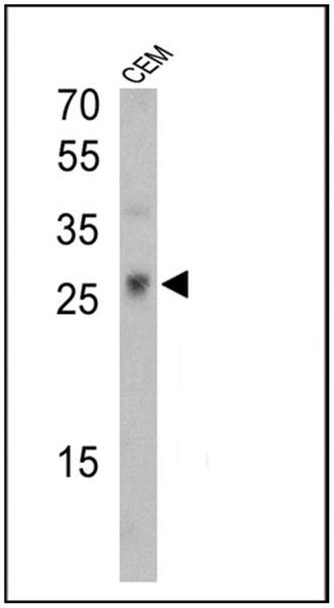 TCR V gamma 9 Antibody in Western Blot (WB)