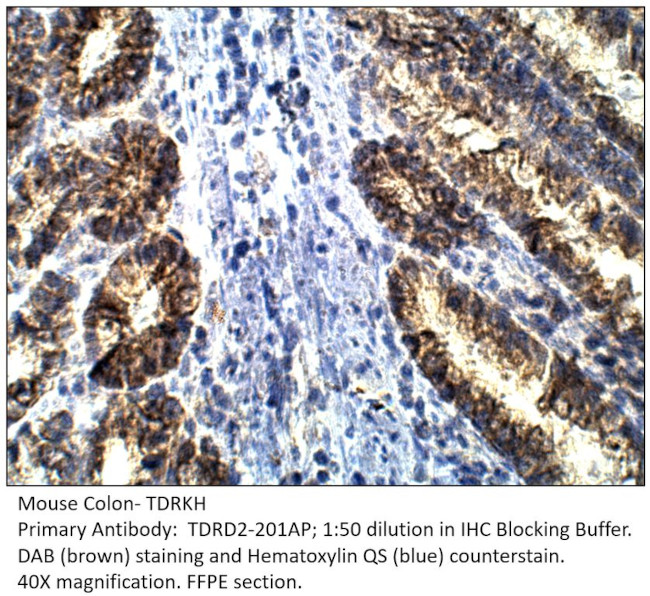 TDRKH Antibody in Immunohistochemistry (IHC)