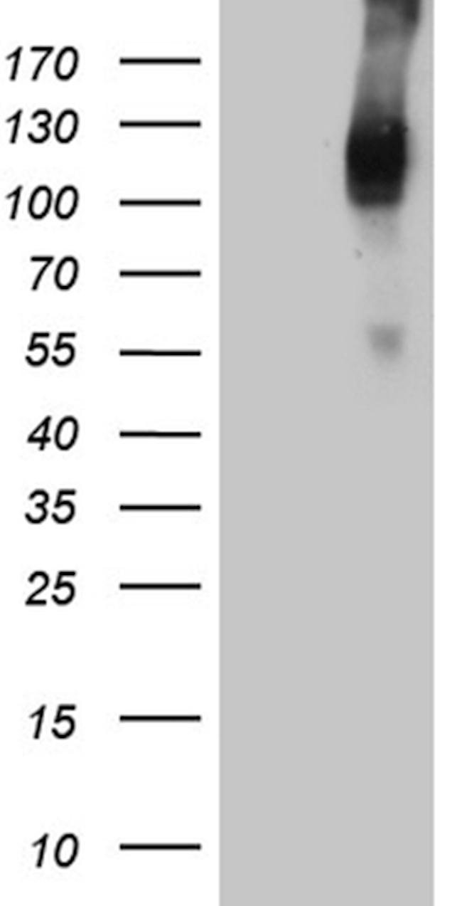 TGFBR3 Antibody in Western Blot (WB)