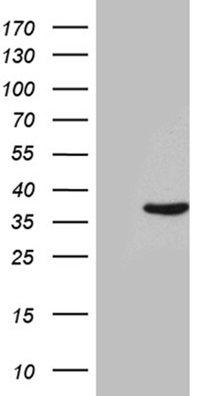 THAP8 Antibody in Western Blot (WB)