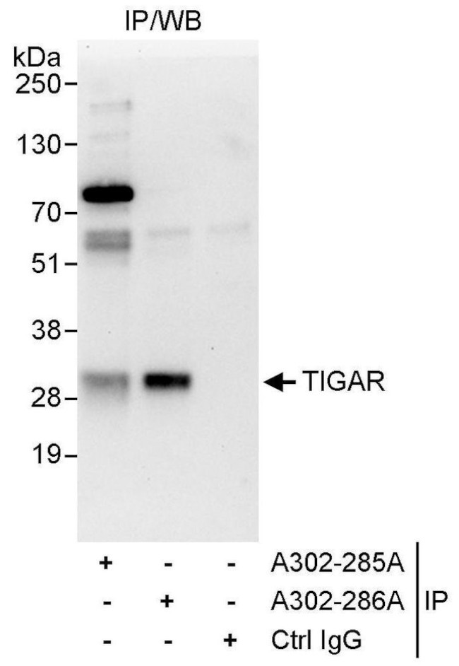 TIGAR Antibody in Immunoprecipitation (IP)