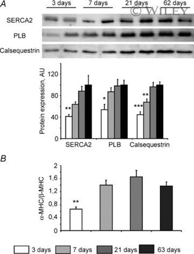 Calsequestrin Antibody in Western Blot (WB)