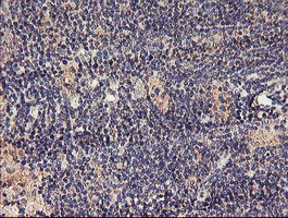 TMEFF2 Antibody in Immunohistochemistry (Paraffin) (IHC (P))