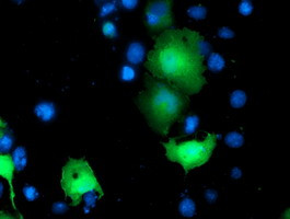 TOMM34 Antibody in Immunocytochemistry (ICC/IF)