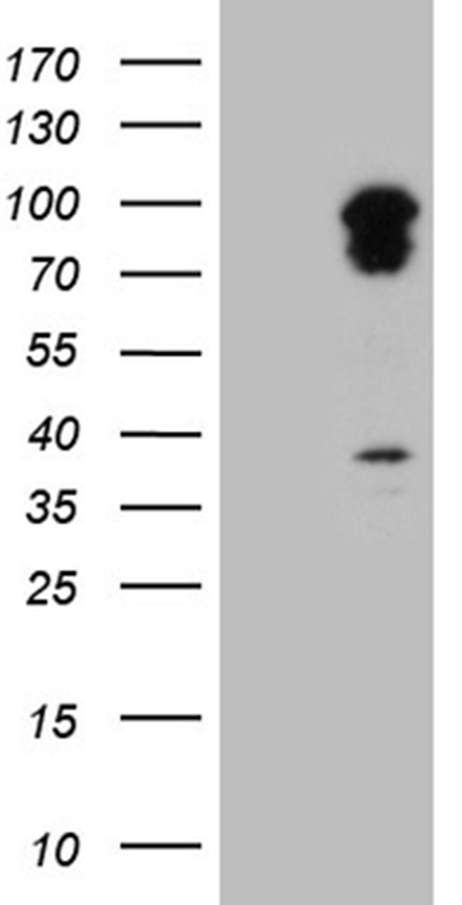 TRAFD1 Antibody in Western Blot (WB)