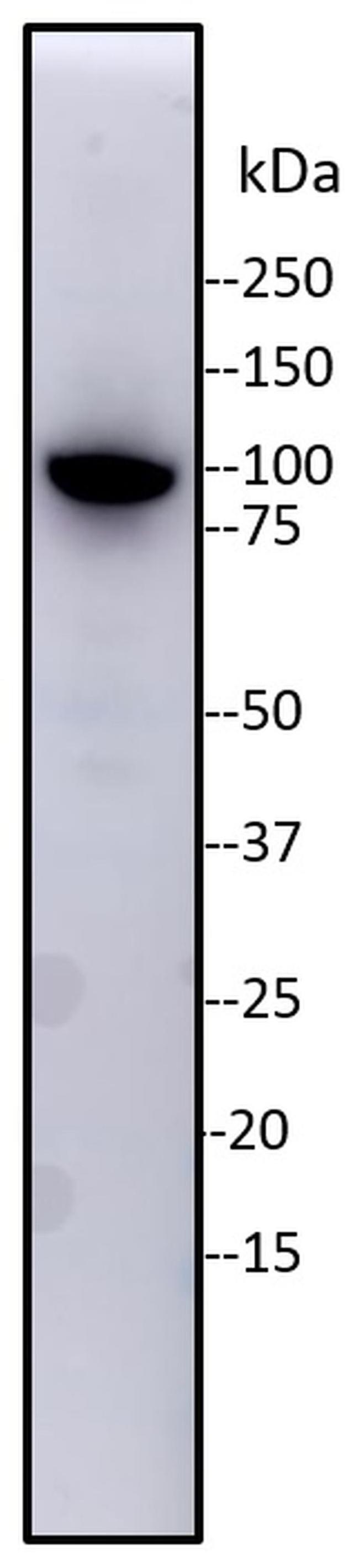 TRIM28 Antibody in Western Blot (WB)