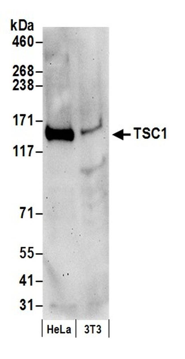 TSC1 Antibody in Western Blot (WB)