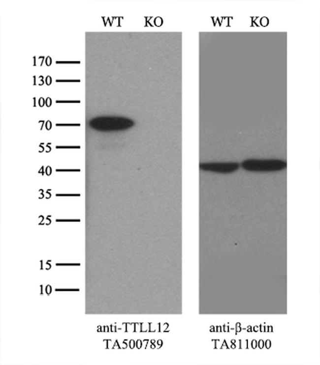 TTLL12 Antibody in Western Blot (WB)