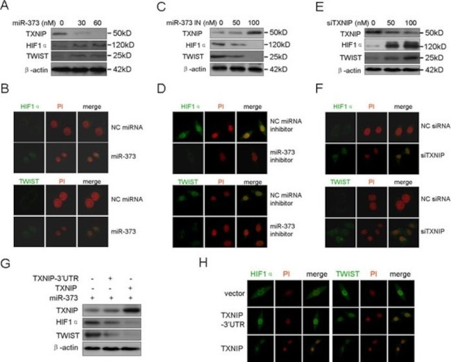 TXNIP Antibody in Western Blot (WB)