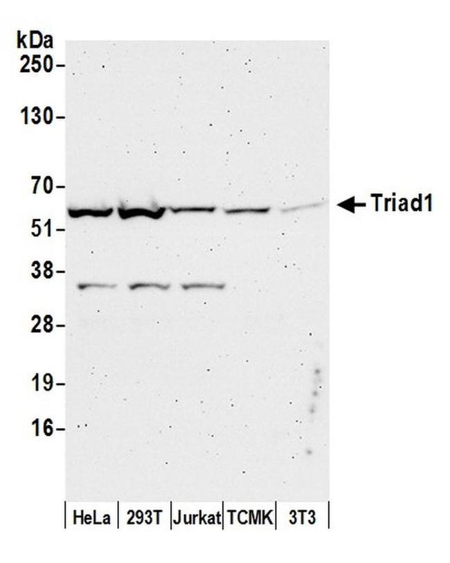 Triad1 Antibody in Western Blot (WB)