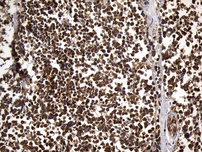 UCHL1 Antibody in Immunohistochemistry (Paraffin) (IHC (P))