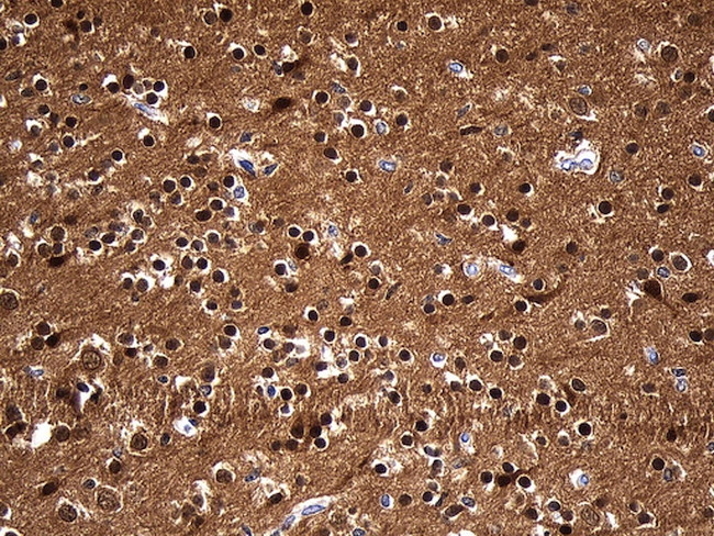 UCHL1 Antibody in Immunohistochemistry (Paraffin) (IHC (P))