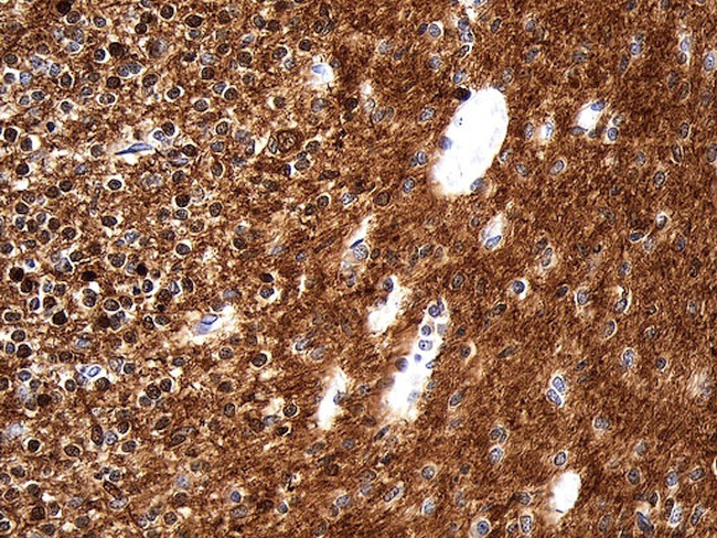 UCHL1 Antibody in Immunohistochemistry (Paraffin) (IHC (P))