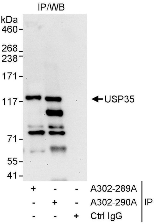 USP35 Antibody in Immunoprecipitation (IP)