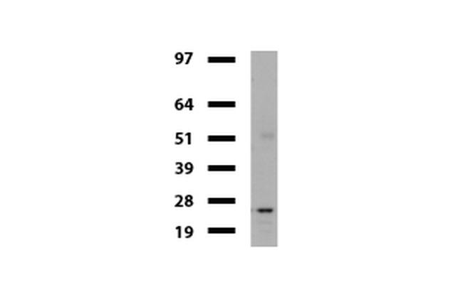 VBP1 Antibody in Western Blot (WB)