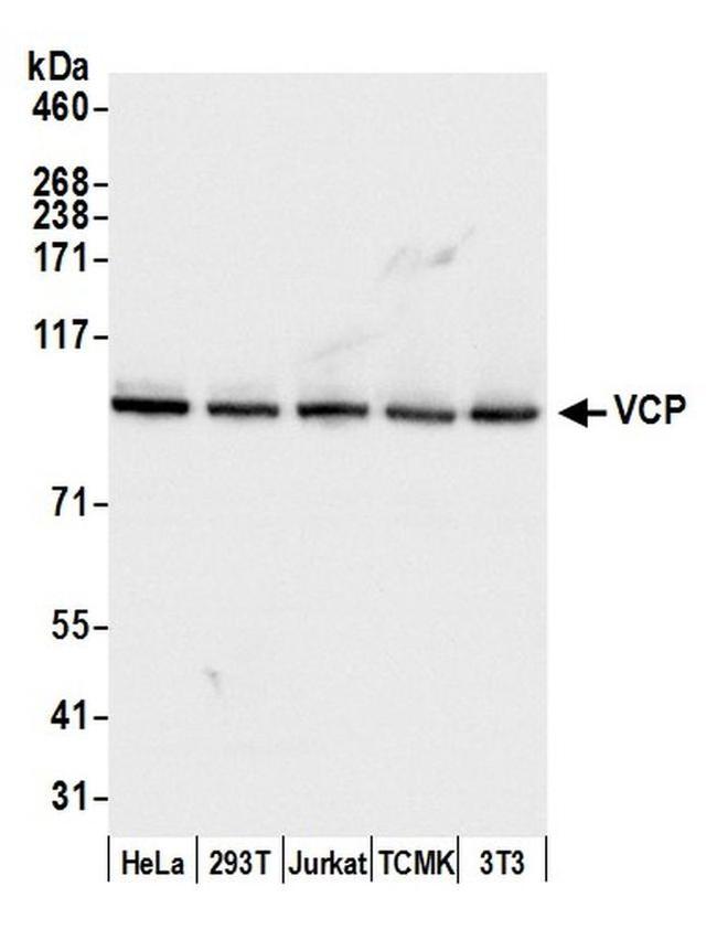 VCP Antibody in Western Blot (WB)