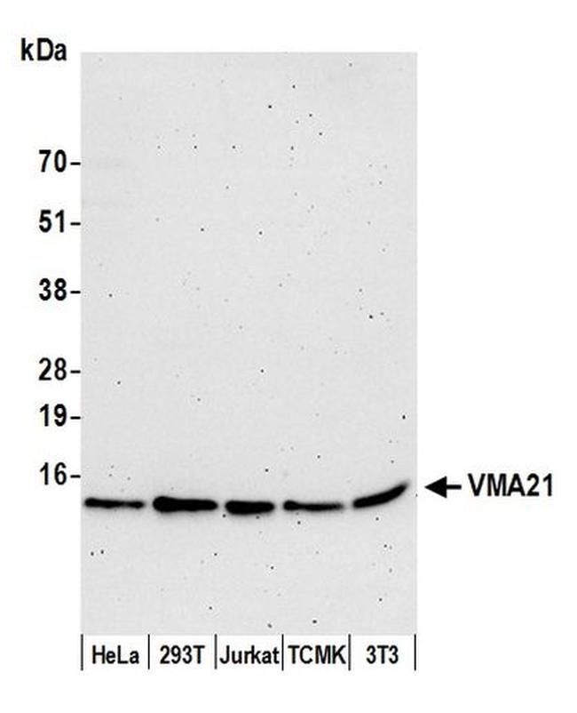 VMA21 Antibody in Western Blot (WB)