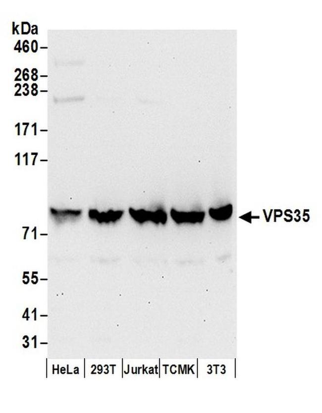 VPS35 Antibody in Western Blot (WB)