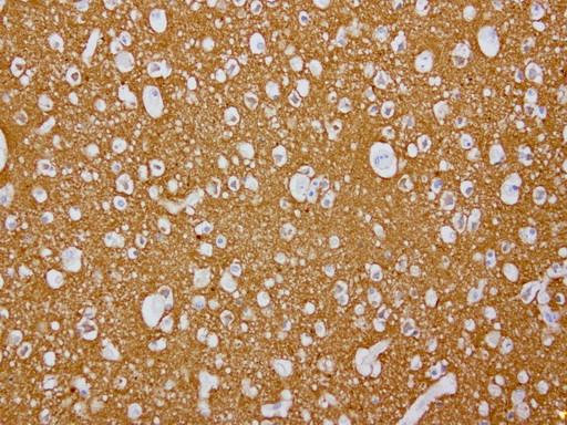 VSNL1 Antibody in Immunohistochemistry (Paraffin) (IHC (P))