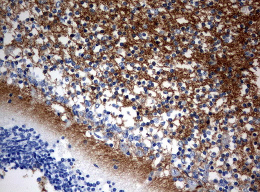 VSNL1 Antibody in Immunohistochemistry (Paraffin) (IHC (P))