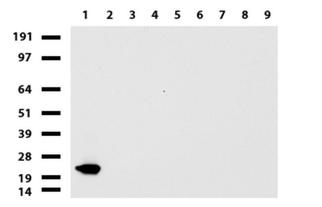 VSNL1 Antibody in Western Blot (WB)