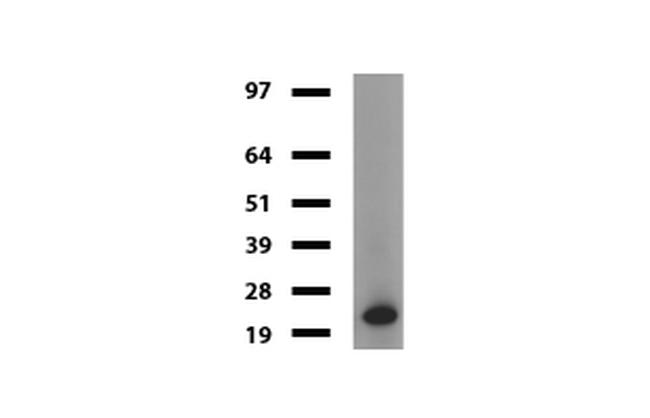 VSNL1 Antibody in Western Blot (WB)