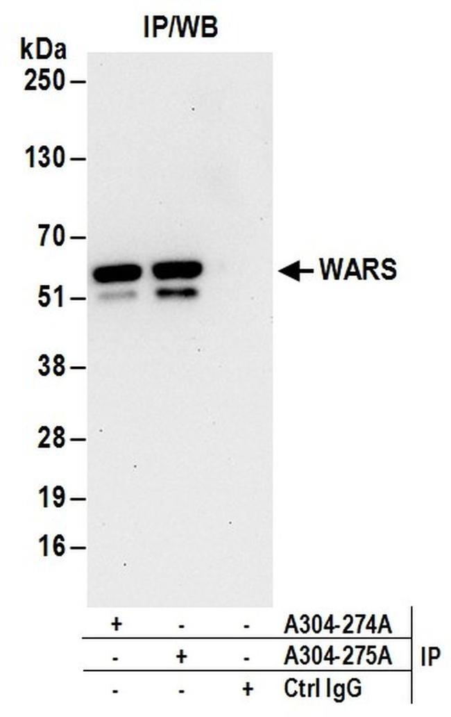 WARS Antibody in Western Blot (WB)