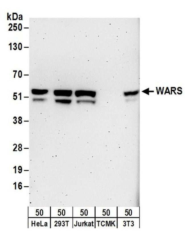 WARS Antibody in Western Blot (WB)