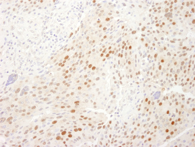 WDR77/MEP50 Antibody in Immunohistochemistry (IHC)